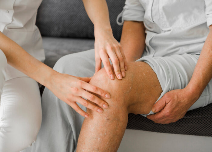 Varicose Vein Treatment Near Me: Minimally Invasive Solutions for Lasting Relief