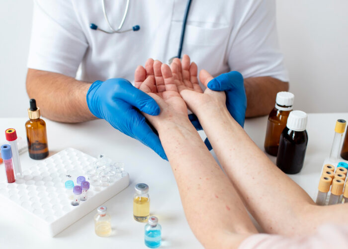 Spider Vein Removal Near Me in Verona, NJ: Safe & Effective Treatment Options