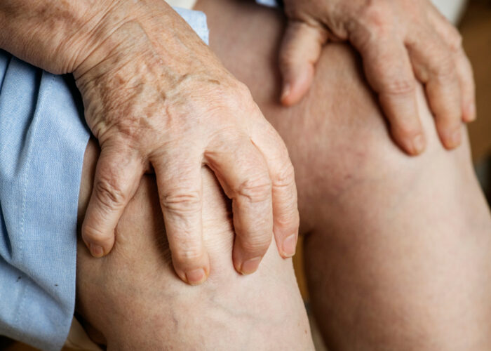 Chronic Venous Insufficiency Treatment Near Me: Causes, Symptoms & Modern Solutions