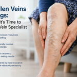 Swollen Veins in Legs: When It’s Time to See a Vein Specialist