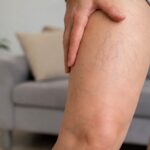 Why Are Veins Showing Through My Skin? Causes, Symptoms, and Treatment Options